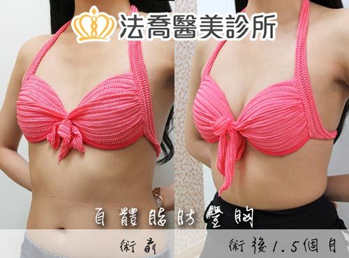 法喬醫美診所 邱浚彥
