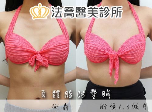 法喬醫美診所 邱浚彥