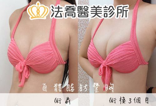 法喬醫美診所 邱浚彥