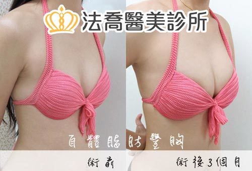 法喬醫美診所 邱浚彥