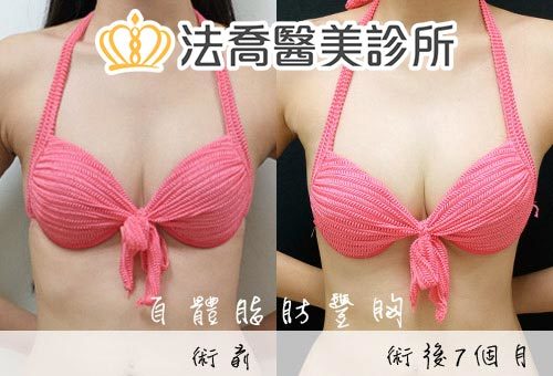 法喬醫美診所 邱浚彥