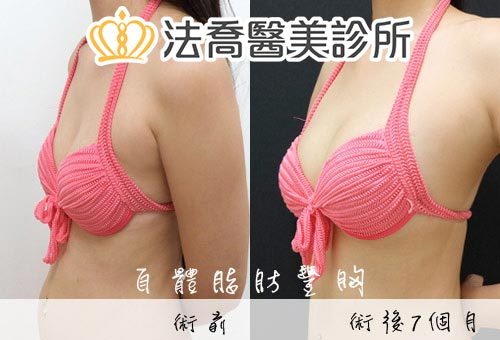 法喬醫美診所 邱浚彥