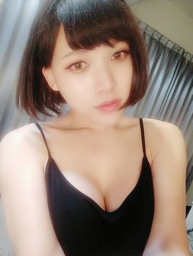 法喬邱浚彥隆乳術後90天案例照