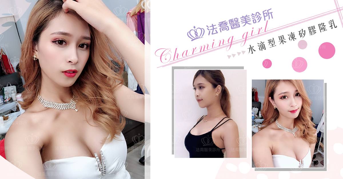 法喬醫美診所-水滴型果凍矽膠隆乳