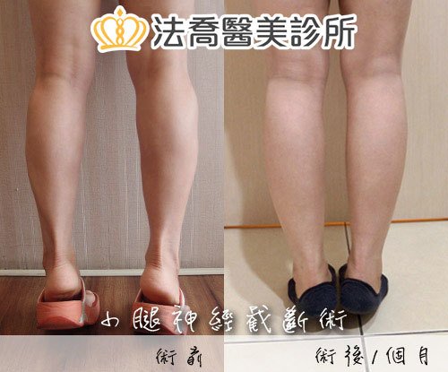 法喬醫美診所 邱浚彥醫師
