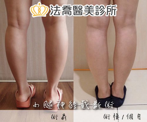 法喬醫美診所 邱浚彥醫師