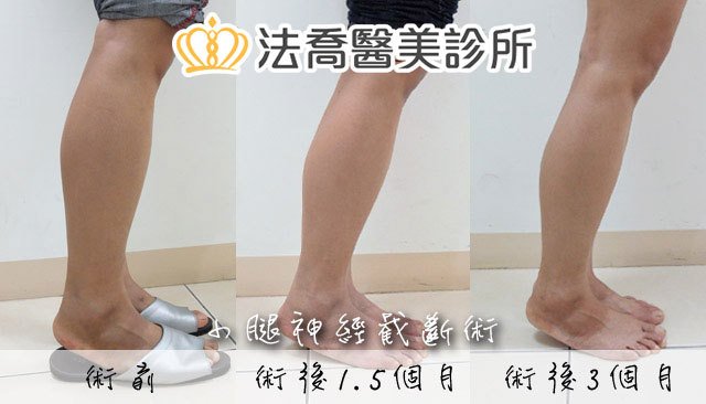 法喬醫美診所 邱浚彥醫師