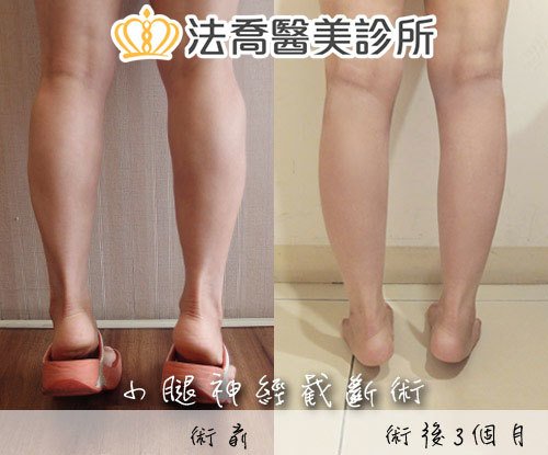 法喬醫美診所 邱浚彥醫師