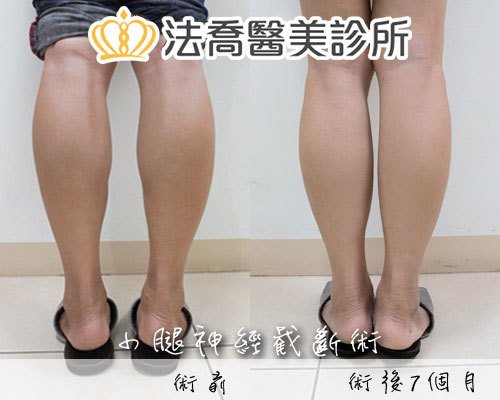 法喬醫美診所 邱浚彥醫師