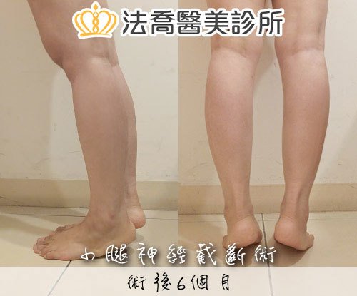 法喬醫美診所 邱浚彥醫師