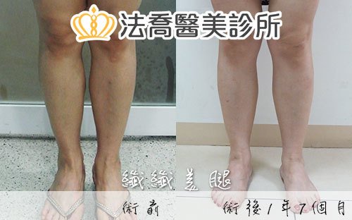 法喬醫美診所 邱浚彥醫師