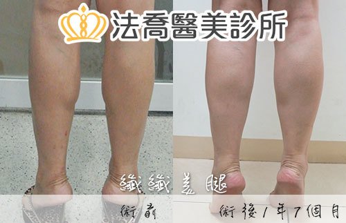 法喬醫美診所 邱浚彥醫師