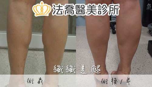 法喬醫美診所 邱浚彥醫師