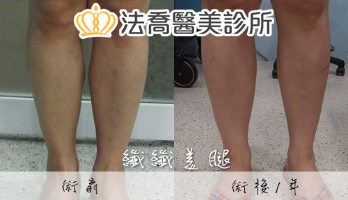 法喬醫美診所 邱浚彥醫師