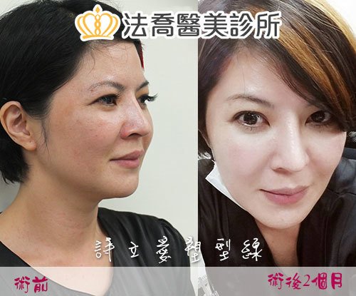 法喬醫美診所 邱浚彥醫師