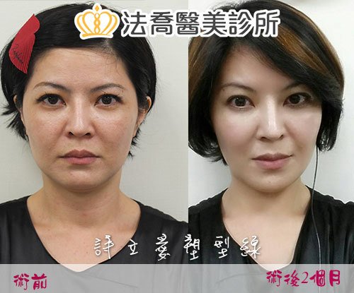 法喬醫美診所 邱浚彥醫師