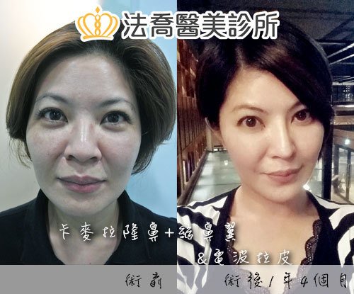 法喬醫美診所 邱浚彥醫師