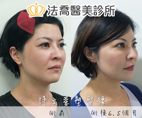 法喬醫美診所 邱浚彥醫師