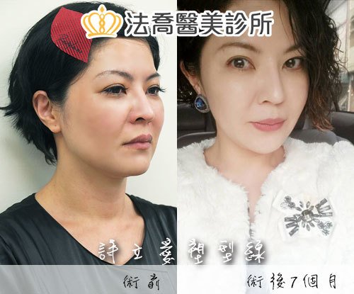 法喬醫美診所 邱浚彥醫師