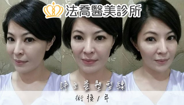 法喬醫美診所 邱浚彥醫師