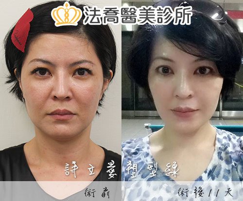 法喬醫美診所 邱浚彥醫師