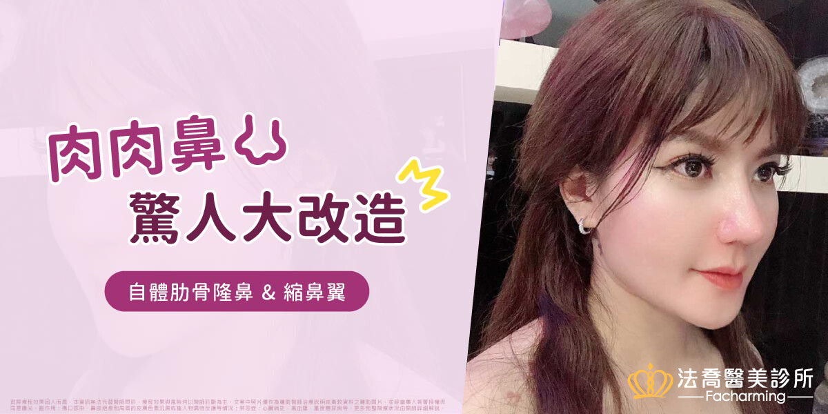 YOYO肋骨隆鼻案例首圖
