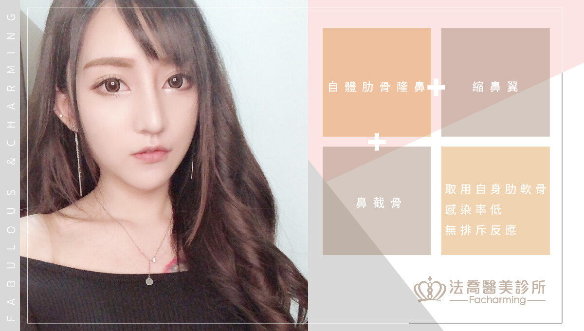 法喬醫美診所隆鼻權威邱浚彥醫師案例作品