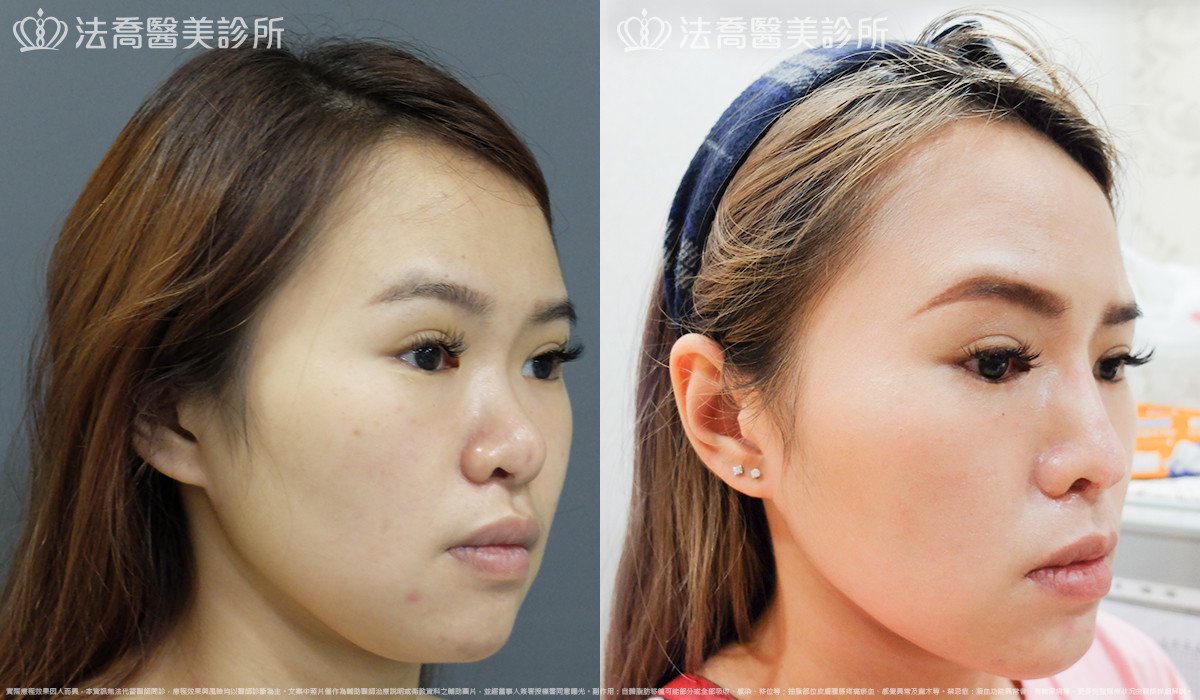 法喬醫美診所 邱浚彥醫師