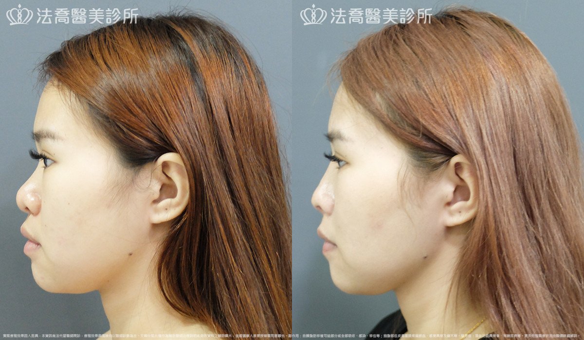 法喬醫美診所 邱浚彥醫師