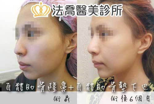 法喬醫美診所 邱浚彥醫師