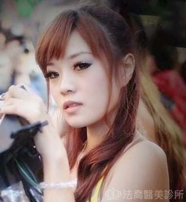 法喬醫美診所_自體肋骨術前