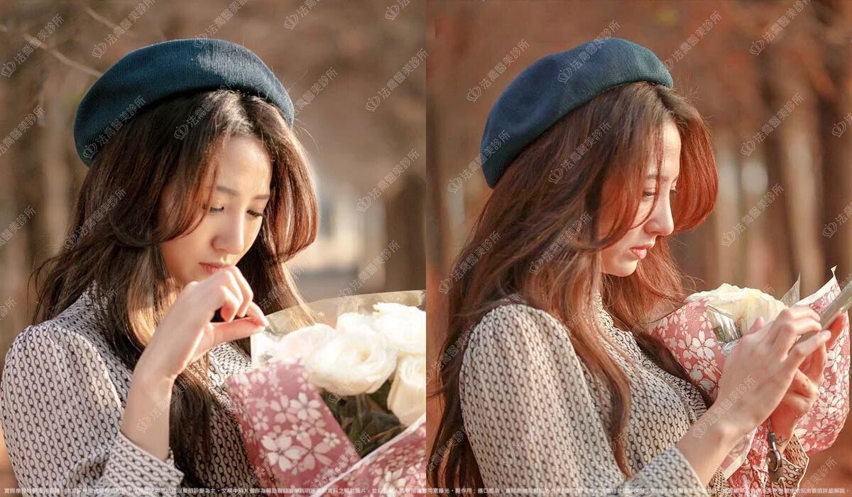 法喬醫美診所,邱浚彥,自體肋骨隆鼻,隆鼻推薦