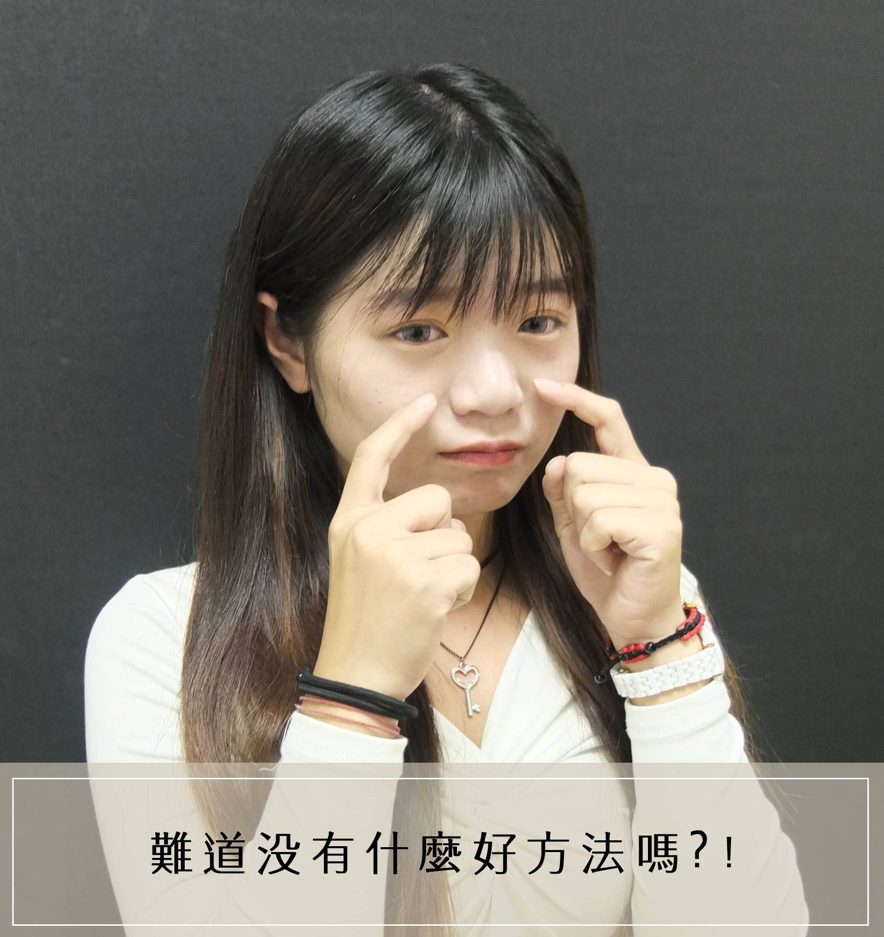 法喬醫美診所_骨水泥下巴術前