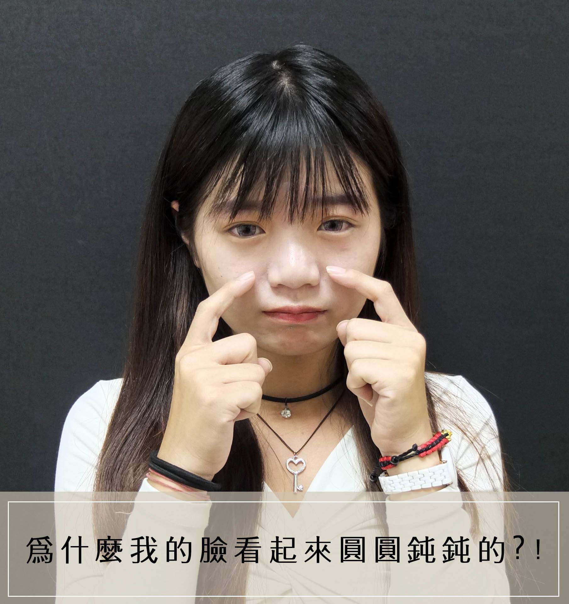 法喬醫美診所_骨水泥下巴術前