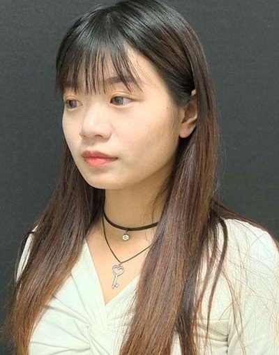 自體肋骨隆鼻