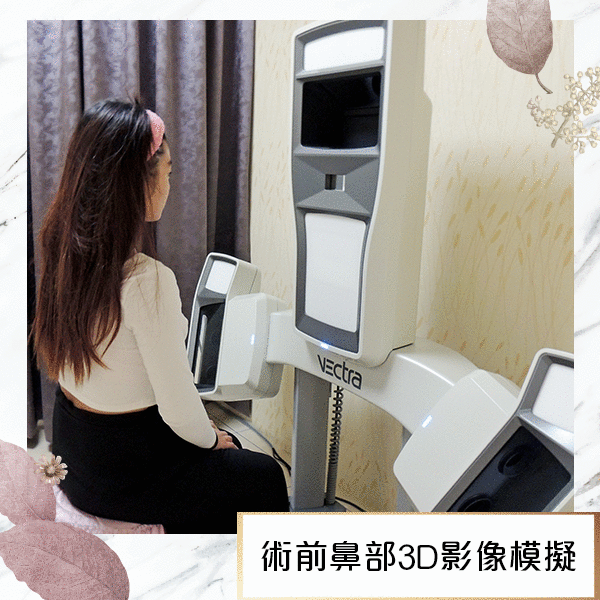 法喬醫美診所_3D模擬下巴