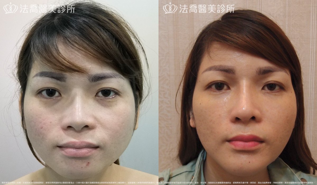 法喬醫美診所 邱浚彥醫師