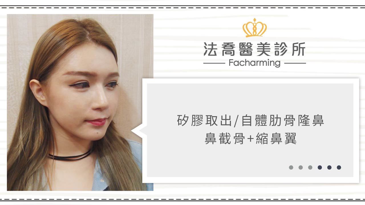 法喬醫美診所_自體肋骨隆鼻術前