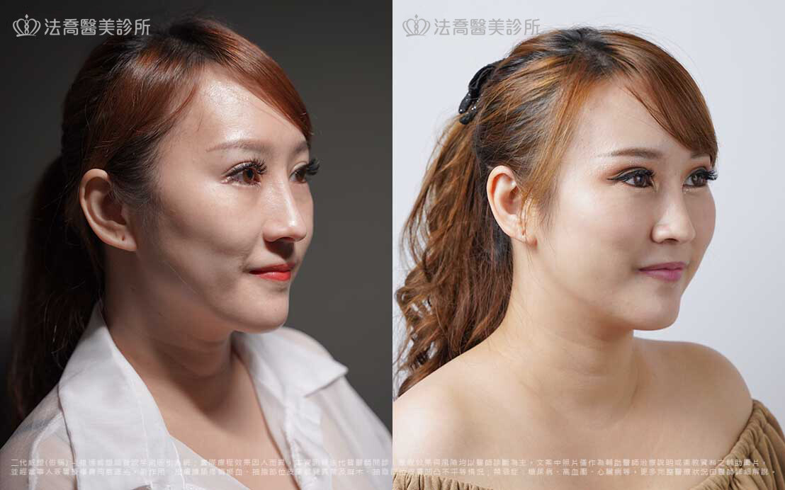 衰臉