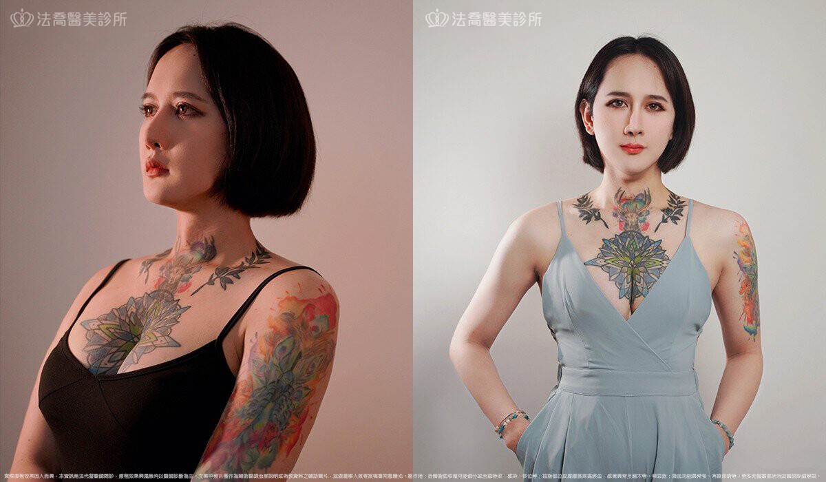 豐臉
