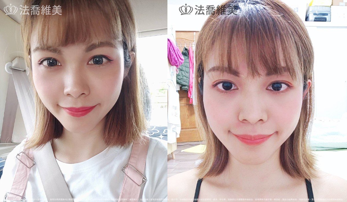 豐臉