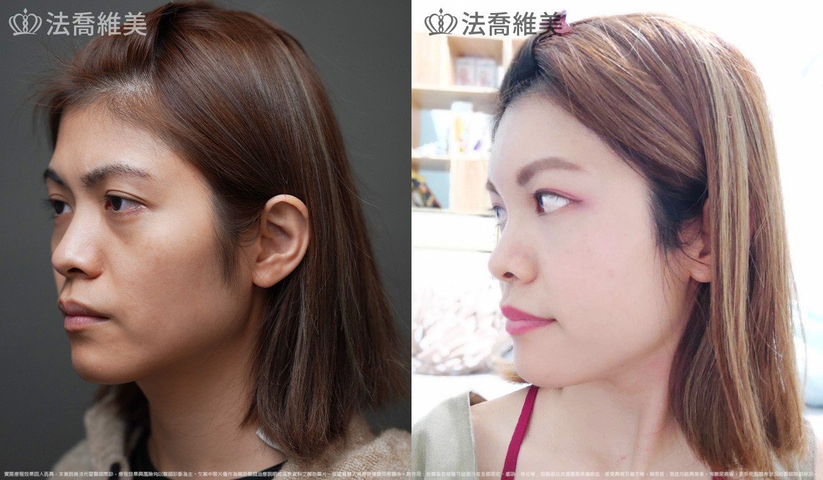 補脂