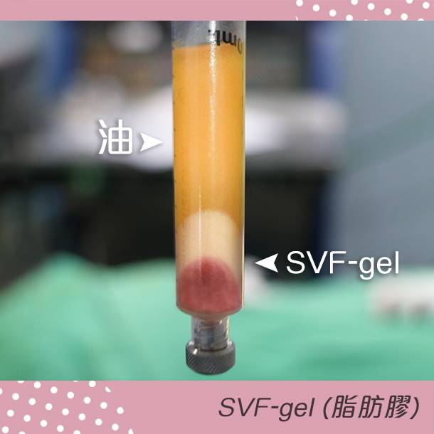 法喬醫美診所脂肪膠