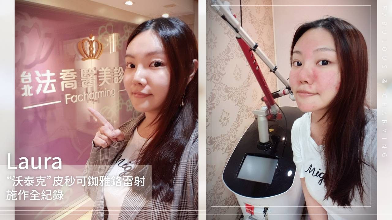 法喬醫美皮秒雷射PICOCARE
