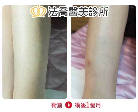 法喬醫美診所 邱浚彥醫師
