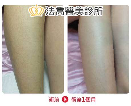 法喬醫美診所 邱浚彥醫師