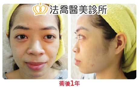 法喬醫美診所 邱浚彥醫師