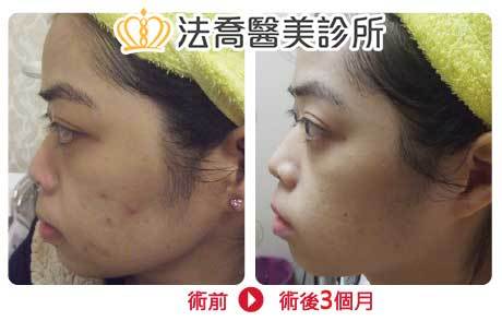 法喬醫美診所 邱浚彥醫師