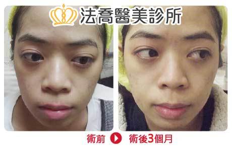 法喬醫美診所 邱浚彥醫師