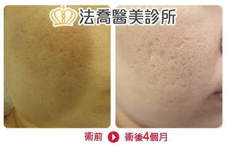 法喬醫美診所 邱浚彥醫師
